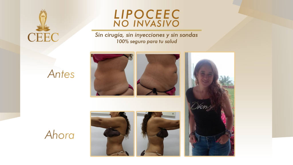susana